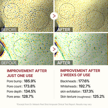 Dr Melaxin™ Peel Shot Duo